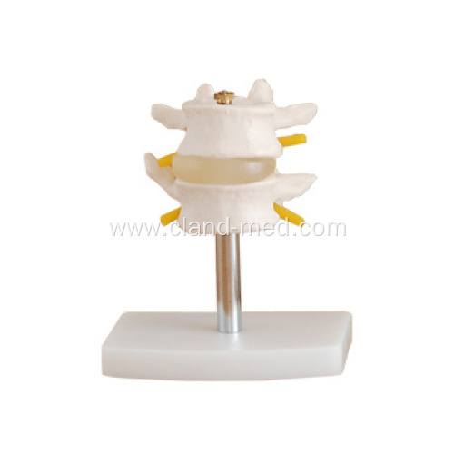 Medical Lumbar Set(2 pcs) Model